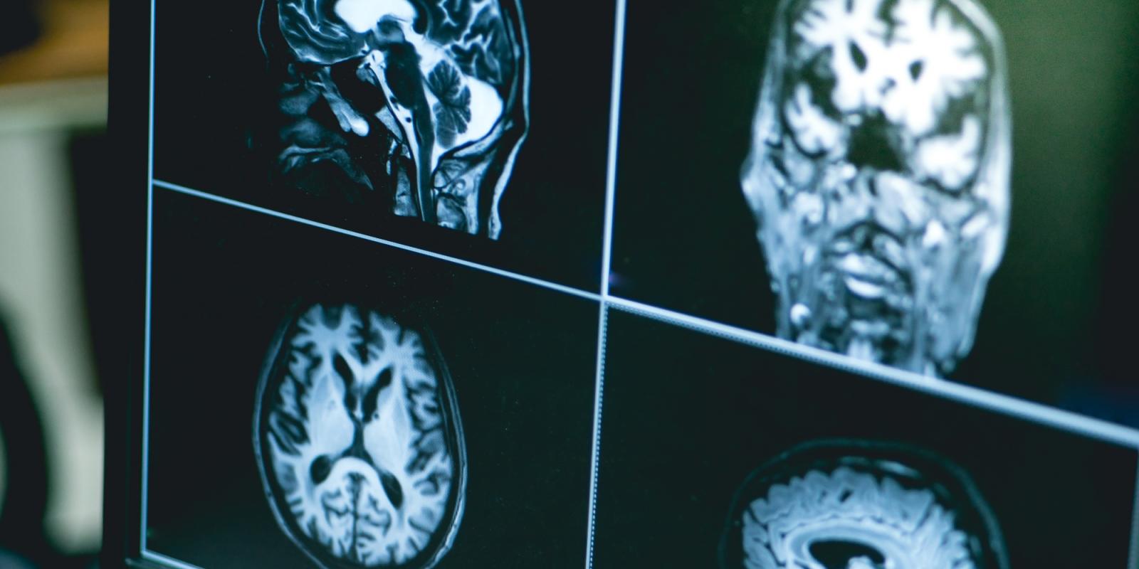 Featured image for In COVID’s Wake Featured image for In COVID's Wake